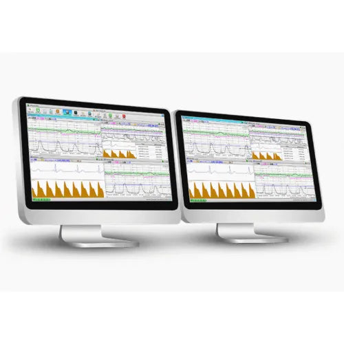 Two computer monitors displaying a graph with orange and green lines on a white background