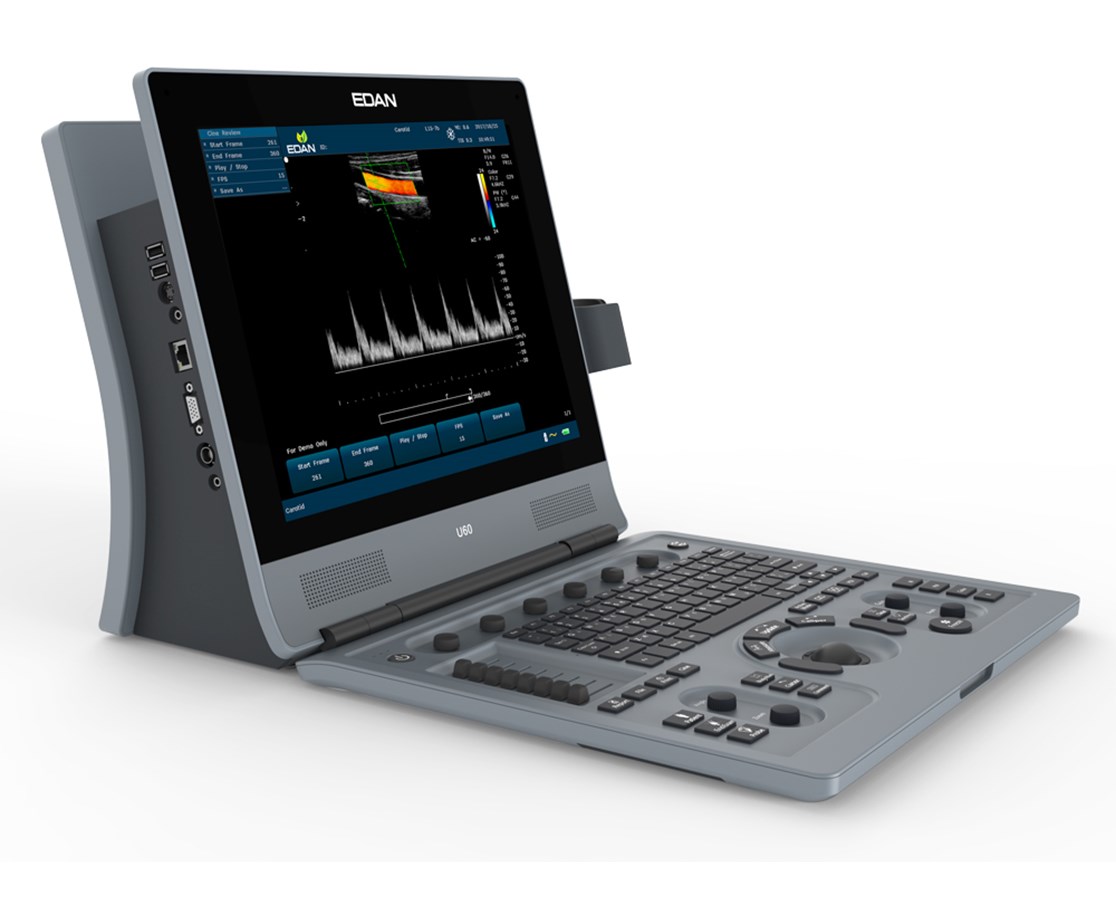 EDAN U60 Diagnostic Ultrasound System