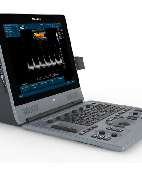 U60 Diagnostic Ultrasound System