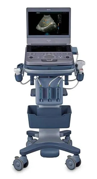 A medical ultrasound machine on a wheeled cart, featuring a gray and blue console with an attached monitor displaying an ultrasound image, three transducer probes, and a storage tray, isolated on a white background.