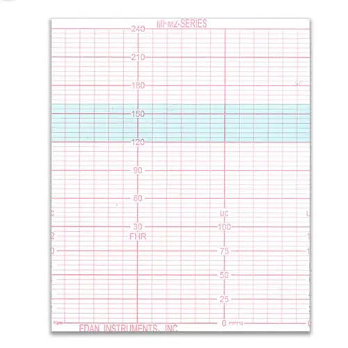 Edan Cadence/Cadence II MFM-2 Fetal Monitors Recording