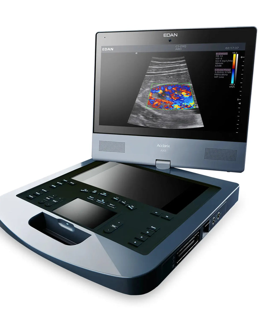 Ultrasound machine with a screen displaying an ultrasound image on a white background