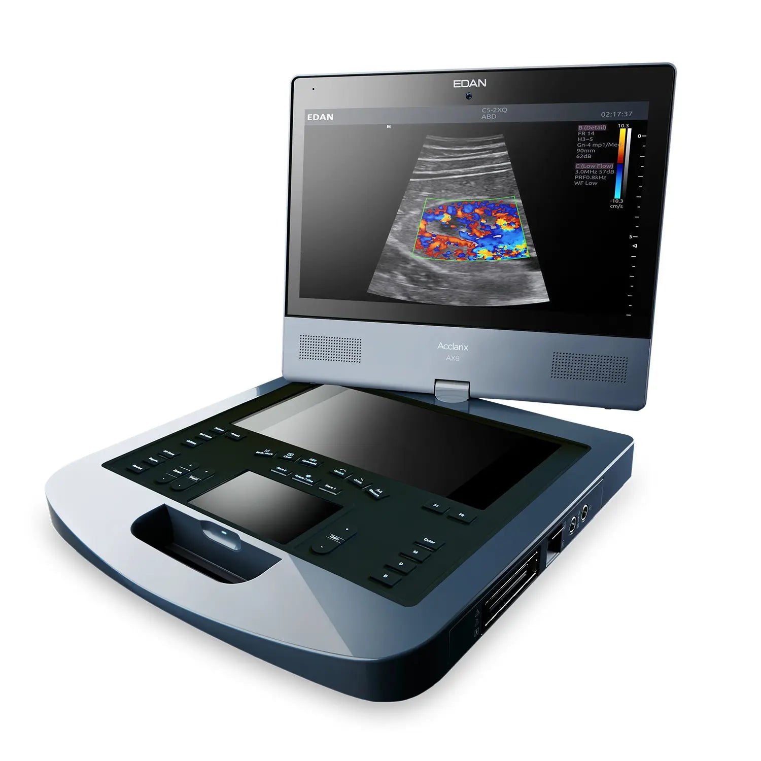 Ultrasound machine with a screen displaying an ultrasound image on a white background