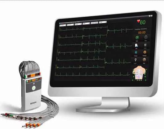 Edan SE-1515 Workstation