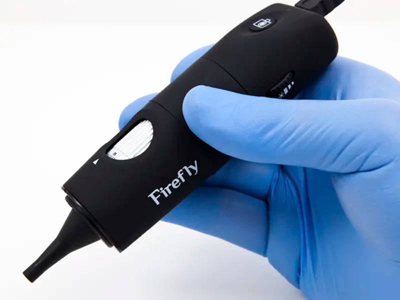 DE500 Digital Video Otoscope