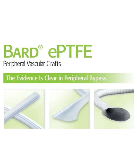 BARD ePTFE Peripheral Vascular Grafts promotional graphic on a white background, with green and black text and three small inset photos showing the graft material in use.