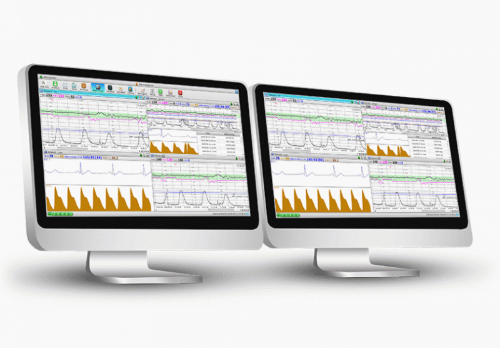 EDAN MFM-CNS Central Monitoring System