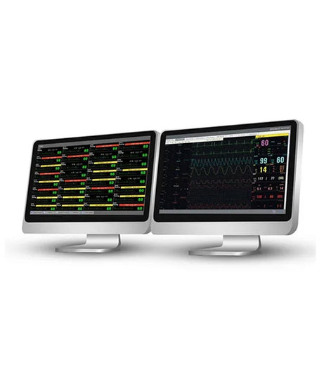 EDAN MFM-CMS Monitoring System