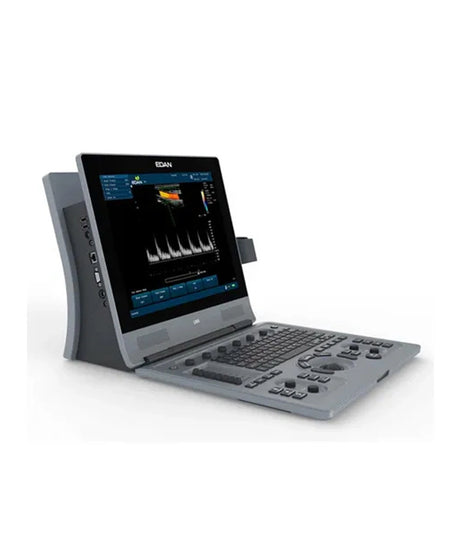 A portable medical ultrasound machine with a gray control console, angled screen, and attached ultrasound probe, shown on a clean white background.
