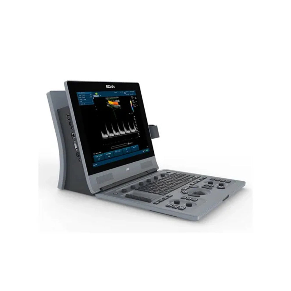A portable medical ultrasound machine with a gray control console, angled screen, and attached ultrasound probe, shown on a clean white background.