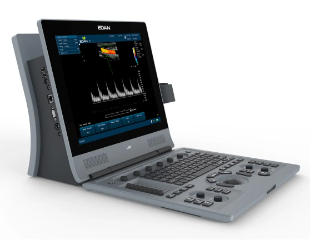  U60 Diagnostic Ultrasound System