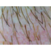 DE300 Digital Polarizing Dermatoscope Dermascope Skin Image  1