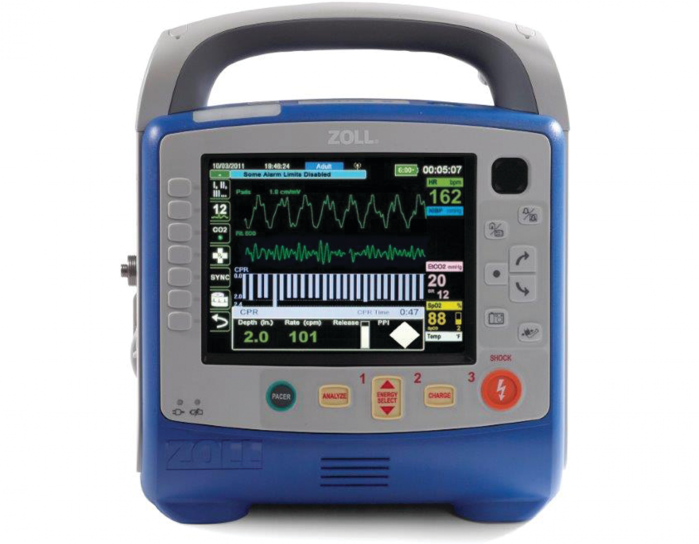 Zoll X Series Defibrillator